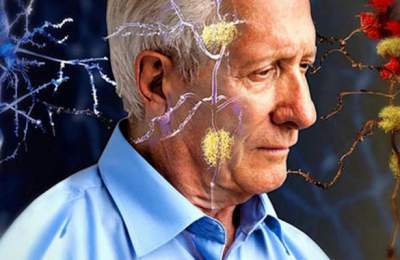 Старческое слабоумие будут лечить заранее